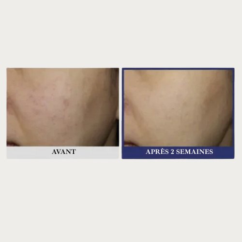 SUNGBOON EDITOR - Centell Lacto Skin Barrier Relaxing Cream