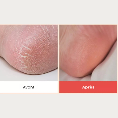 SUNGBOON EDITOR - Shea Butter Baby Foot Stick